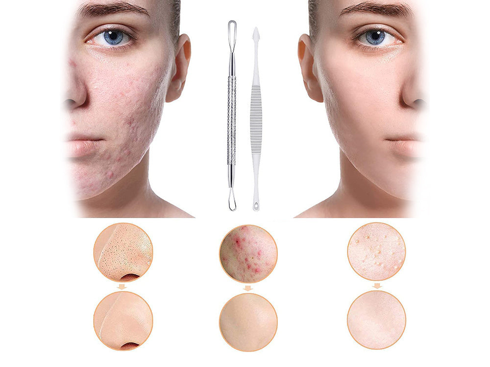 Speakerių rinkinys, skirtas skalkulinių kiautų šalinimui x 7