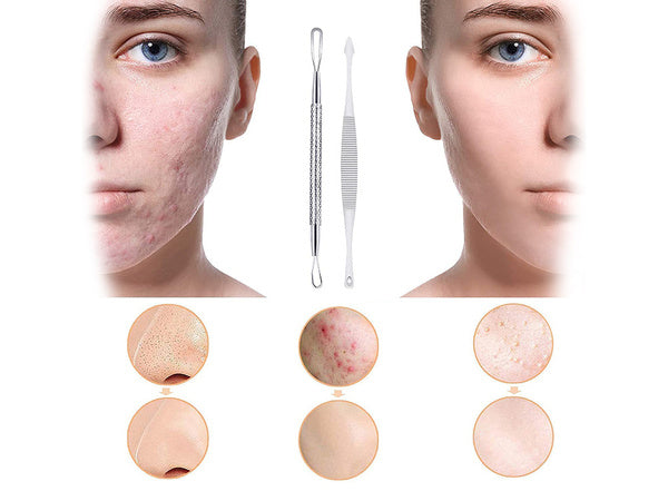 Speakerių rinkinys, skirtas skalkulinių kiautų šalinimui x 7