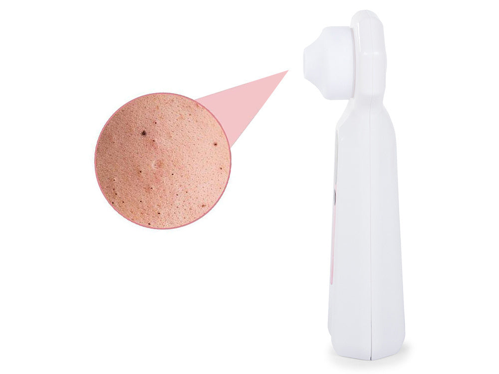 Juodagalvių ir spuogų siurblys paskatino didintuvą