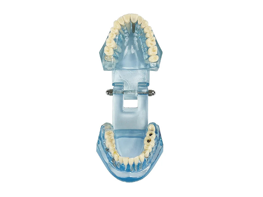 Dantų modelis žandikaulio dantys dantų implantai