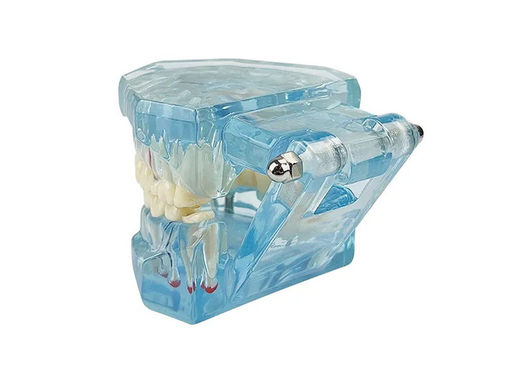 Dantų modelis žandikaulio dantys dantų implantai