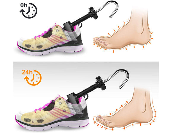 Avalynės neštuvai hallux valgus 39-43