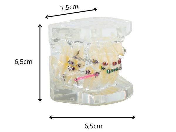 Dantų modelis su žandikauliu ir breketais (mokomasis)