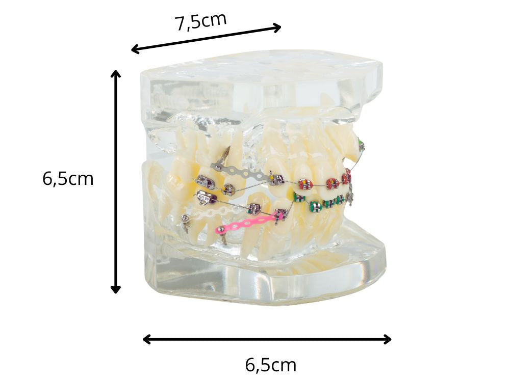 Dantų modelis su žandikauliu ir breketais (mokomasis)